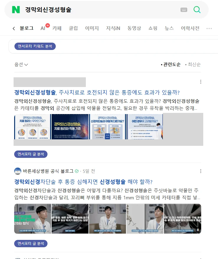 경막외신경성형술 10.27