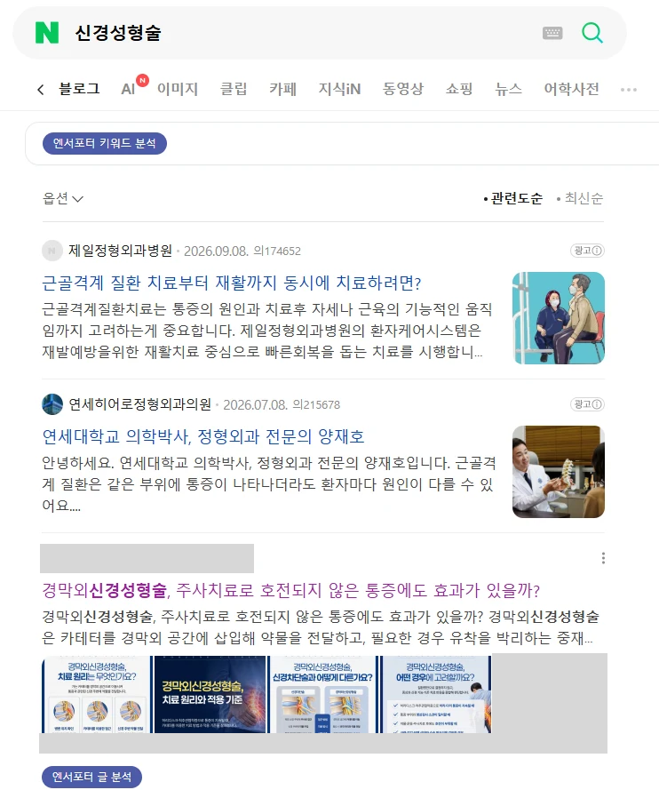 신경성형술 10.27 