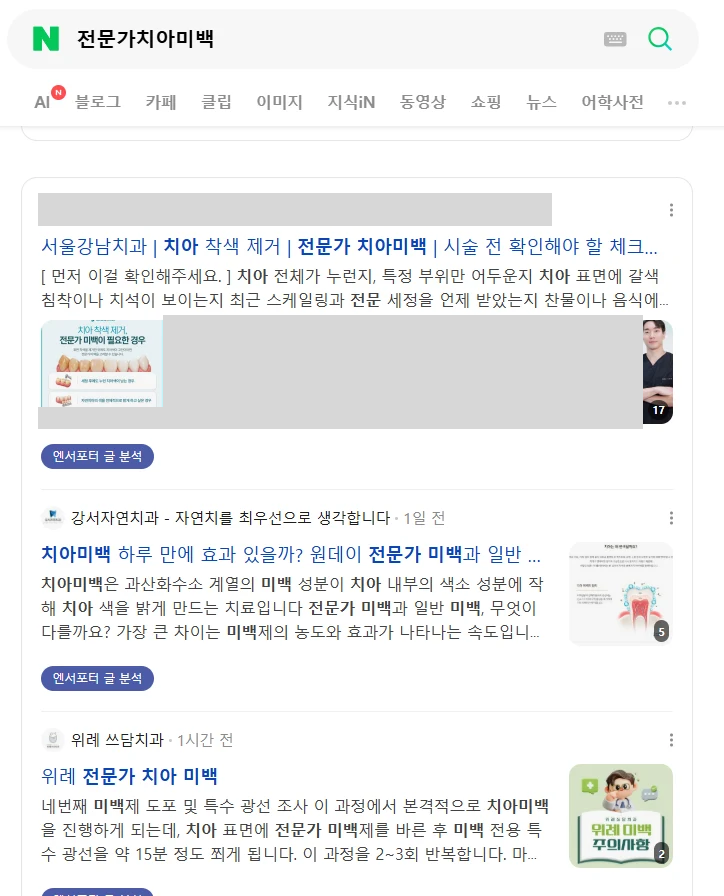 전문가치아미백 10.07
