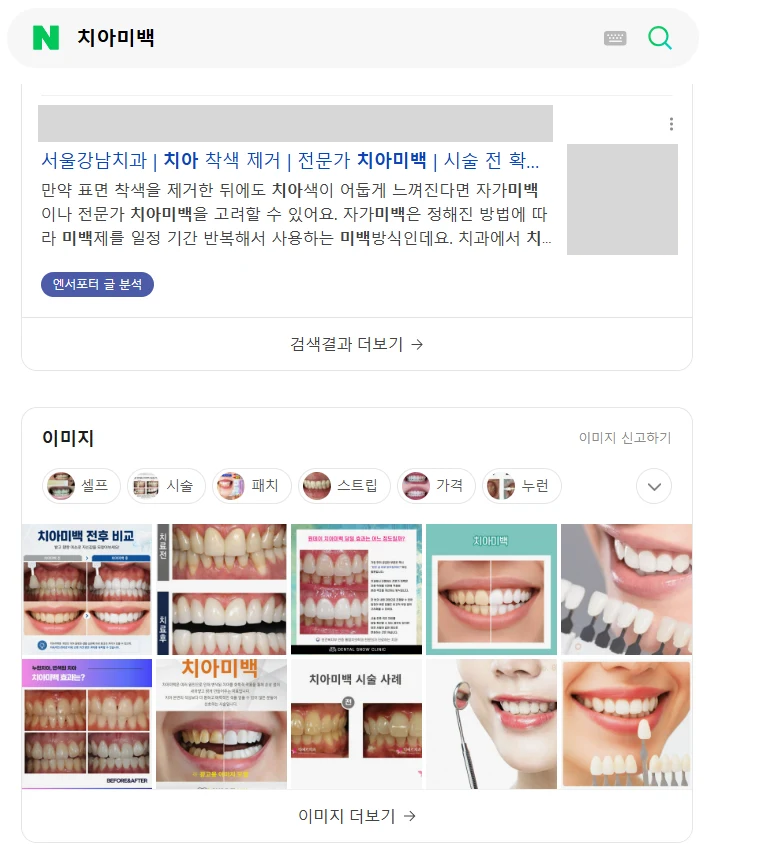 치아미백 10.07