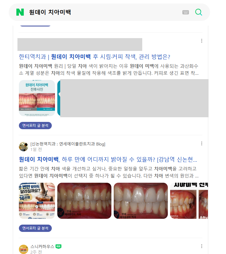 원데이 치아미백 · 검색 결과(탭 미표시) · 2026.10.29